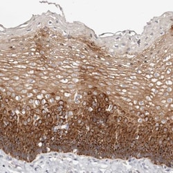 VIPAR Antibody, Novus Biologicals:Antibodies:Primary Antibodies